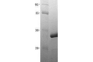 Validation with Western Blot (UBE2D4 Protein (His tag))