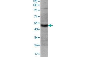 Western blot analysis using TNFRSF8 monoclonal antibody, clone 3B10  against HeLa cell lysate.
