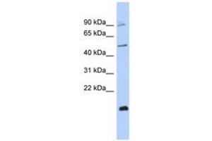 Image no. 1 for anti-Zinc Finger Protein 645 (ZNF645) (C-Term) antibody (ABIN6742924) (ZNF645 antibody  (C-Term))