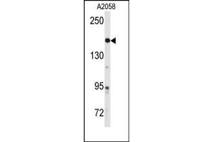 Image no. 1 for anti-ABL2 (ABL2) (Center) antibody (ABIN358073)