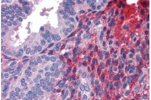 Human Uterus (formalin-fixed, paraffin-embedded) stained with DCST1 antibody ABIN462239 followed by biotinylated goat anti-rabbit IgG secondary antibody ABIN481713, alkaline phosphatase-streptavidin and chromogen. (DCST1 antibody  (C-Term))