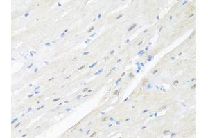 Immunohistochemistry of paraffin-embedded mouse heart using RBFOX3 antibody (ABIN1874561) at dilution of 1:100 (40x lens). (NeuN antibody)
