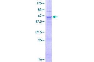 AGPAT2 Protein (AA 1-278) (GST tag)