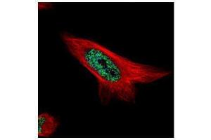 ICC/IF Image Confocal immunofluorescence analysis (Olympus FV10i) of paraformaldehyde-fixed HeLa, using MAML1, antibody (Green) at 1:500 dilution. (MAML1 antibody  (N-Term))