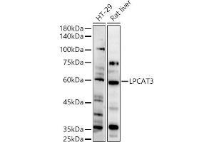 Western blot analysis of extracts of various cell lines, using LPC antibody (ABIN7268337) at 1:500 dilution. (LPCAT3 antibody  (AA 160-370))