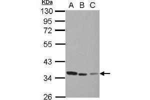 WB Image Sample (30 ug of whole cell lysate) A: Jurkat B: Raji C: THP-1 10% SDS PAGE antibody diluted at 1:1000 (TYMS antibody)