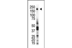 Western blot analysis of anti-RON Pab in THP1 cell lysate