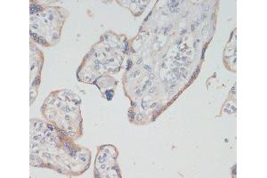 Immunohistochemistry of paraffin-embedded Human placenta using CHAT Polyclonal Antibody at dilution of 1:200 (40x lens). (Choline Acetyltransferase antibody)