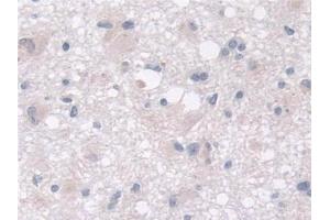 Immunohistochemistry (IHC) image for anti-MOCO Sulphurase C-terminal Domain Containing 1 (MOSC1) (AA 41-335) antibody (ABIN7430258)