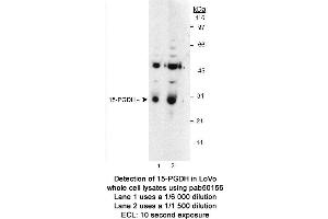 Image no. 1 for anti-Hydroxyprostaglandin Dehydrogenase 15-(NAD) (HPGD) antibody (ABIN363465) (HPGD antibody)