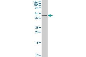 NR4A3 monoclonal antibody (M02), clone 1E9 Western Blot analysis of NR4A3 expression in Hela S3 NE . (NR4A3 antibody  (AA 414-521))