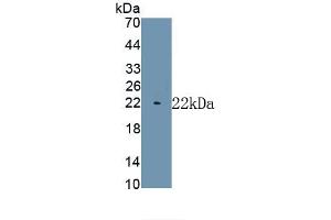 MYH7 antibody  (AA 1777-1935)