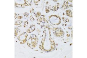 Immunohistochemistry of paraffin-embedded human breast using ILF2 Antibody (ABIN5973487) at dilution of 1/100 (40x lens). (ILF2 antibody)