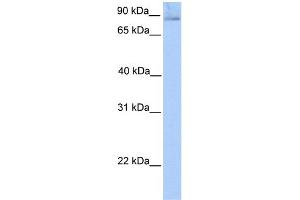 WB Suggested Anti-SLITRK1 Antibody Titration:  0. (SLITRK1 antibody  (N-Term))