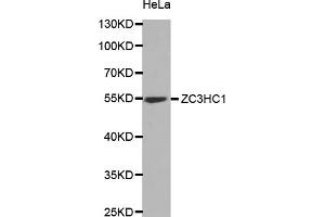 Western blot analysis of extracts of HeLa cells, using ZC3HC1 antibody (ABIN5973745) at 1/1000 dilution. (ZC3HC1 antibody)