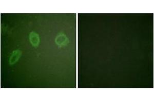 Immunofluorescence analysis of HuvEc cells, using HER2 (Ab-686) Antibody. (ErbB2/Her2 antibody  (AA 661-710))