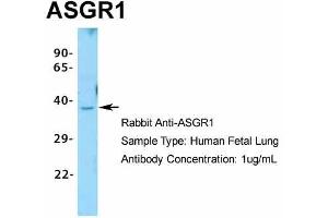 Host:  Rabbit  Target Name:  ASGR1  Sample Type:  Human Fetal Lung  Antibody Dilution:  1. (Asialoglycoprotein Receptor 1 antibody  (N-Term))