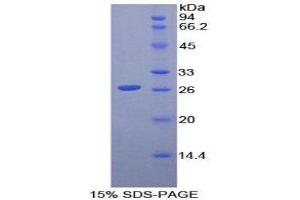 SDS-PAGE (SDS) image for CD79b Molecule, Immunoglobulin-Associated beta (CD79B) (AA 26-225) protein (His tag) (ABIN1879158)