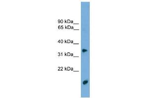 TMPRSS3 antibody used at 1 ug/ml to detect target protein. (TMPRSS3 antibody  (N-Term))
