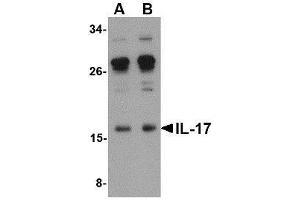 Western blot analysis of IL-17 in A-20 lysate with AP30410PU-N IL-17 antibody at (A) 0. (Interleukin 17a antibody  (Center))