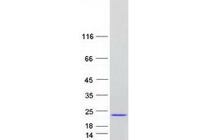Eukaryotic Translation Initiation Factor 5A (EIF5A) (Transcript Variant C) protein (Myc-DYKDDDDK Tag)