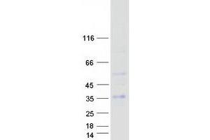 Validation with Western Blot