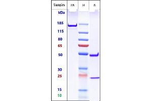 Anti-TREM2 Reference Antibody (Py314) on SDS-PAGE under reducing (R) condition.
