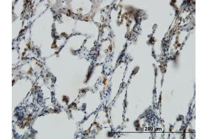 Immunostaining (ISt) image for anti-PRELI Domain Containing 1 (PRELID1) (AA 3-100) antibody (ABIN7477824)