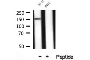 Western blot analysis of extracts of HEK-293 cells, using VPRBP antibody. (VPRBP antibody)
