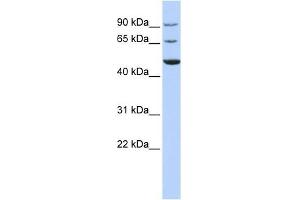 KCND3 antibody used at 1 ug/ml to detect target protein.