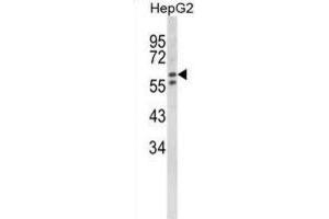 Western Blotting (WB) image for anti-Hexosaminidase A (HEXA) antibody (ABIN3002900)