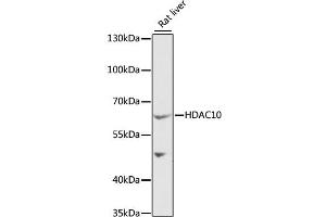 Western blot analysis of extracts of rat liver, using HDAC10 antibody (ABIN1882316) at 1:1000 dilution. (HDAC10 antibody)