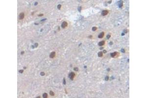 Figure. (MX1 antibody  (AA 400-652))