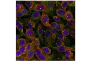 Image no. 1 for anti-Family with Sequence Similarity 129, Member B (FAM129B) (Ser712) antibody (ABIN319365) (MEG3 antibody  (Ser712))