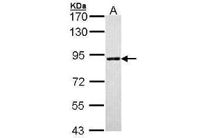 SLC26A8 Antikörper  (C-Term)