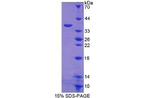 SDS-PAGE (SDS) image for Nuclear Factor-kB p65 (NFkBP65) (AA 19-306) protein (His tag) (ABIN1081107)