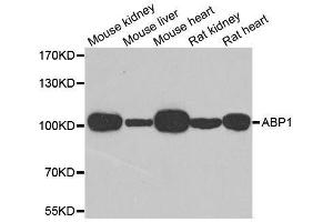 Western blot analysis of extracts of various cell lines, using AOC1 antibody.