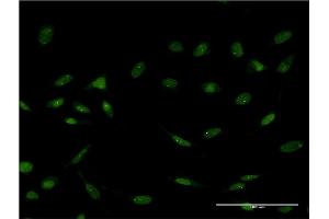 Immunofluorescence of monoclonal antibody to FOXC2 on HeLa cell. (FOXC2 antibody  (AA 156-256))