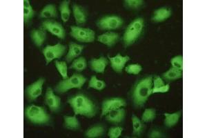 Detection of UCHL1 in A549 cells using Polyclonal Antibody to Ubiquitin Carboxyl Terminal Hydrolase L1 (UCHL1) (UCHL1 antibody  (AA 2-223))