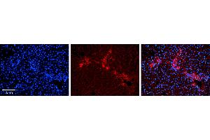 Rabbit Anti-ETF1 Antibody Catalog Number: ARP54738_P050 Formalin Fixed Paraffin Embedded Tissue: Human Liver Tissue Observed Staining: Cytoplasm in bile ductule Primary Antibody Concentration: 1:100 Other Working Concentrations: 1:600 Secondary Antibody: Donkey anti-Rabbit-Cy3 Secondary Antibody Concentration: 1:200 Magnification: 20X Exposure Time: 0. (ETF1 antibody  (N-Term))