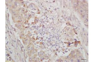 Immunohistochemistry (Paraffin-embedded Sections) (IHC (p)) image for anti-Nuclear Factor of kappa Light Polypeptide Gene Enhancer in B-Cells Inhibitor, epsilon (NFKBIE) (AA 165-270) antibody (ABIN1386753)