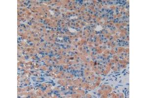 Used in DAB staining on fromalin fixed paraffin- embedded stomach tissue (LCN8 antibody  (AA 25-176))