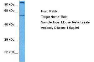 Host: Rabbit Target Name: RELA Sample Tissue: Mouse Testis Antibody Dilution: 1ug/ml (NF-kB p65 antibody  (Middle Region))