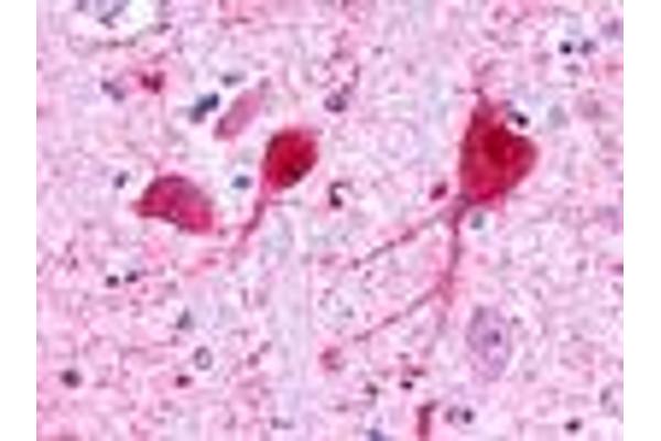 GALR3 antibody  (C-Term)
