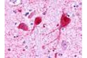Anti-GALR3 antibody IHC of human brain, neurons and glia. (GALR3 antibody  (C-Term))