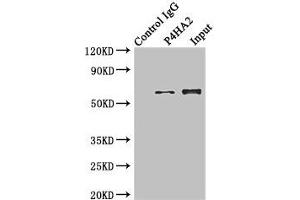 Immunoprecipitating P4HA2 in Hela whole cell lysate Lane 1: Rabbit control IgG instead of (1 μg) instead of ABIN7164785 in Hela whole cell lysate.