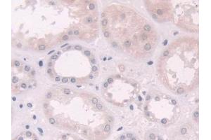 Immunohistochemistry (IHC) image for anti-NAD(P)H Dehydrogenase, Quinone 1 (NQO1) (AA 2-274) antibody (ABIN7430126)
