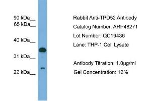 WB Suggested Anti-TPD52  Antibody Titration: 0. (TPD52 antibody  (C-Term))