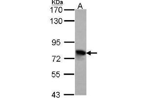 WB Image Sample (30 ug of whole cell lysate) A: Hela 7. (TGFBI antibody)
