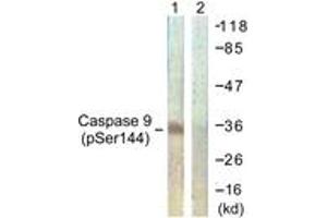 Western blot analysis of extracts from K562 cells, using Caspase 9 (Phospho-Ser144) Antibody.